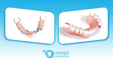 metal vs plastic partial dentures